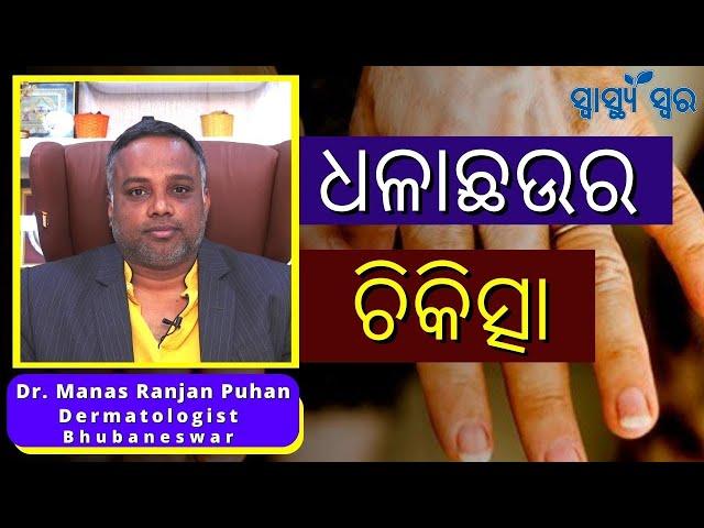 ଜାଣନ୍ତୁ ଧଳାଛଉ ବିଷୟରେ I ଲକ୍ଷଣ, କାରଣ, କାହାକୁ ହୁଏ, ଚିକିତ୍ସା I Dr. Manas Ranjan Puhan I  Swasthya Swara