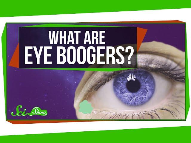 What Are Eye Boogers?