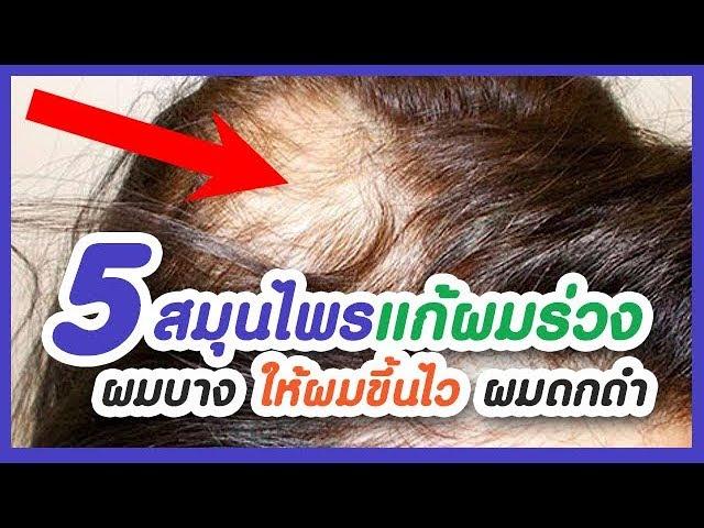 5 สุดยอดสมุนไพรแก้ผมร่วง ผมบาง ให้งอกใหม่เร็วขึ้น ผมดกดำ 5 top herbs to treat hair loss, thin hair.