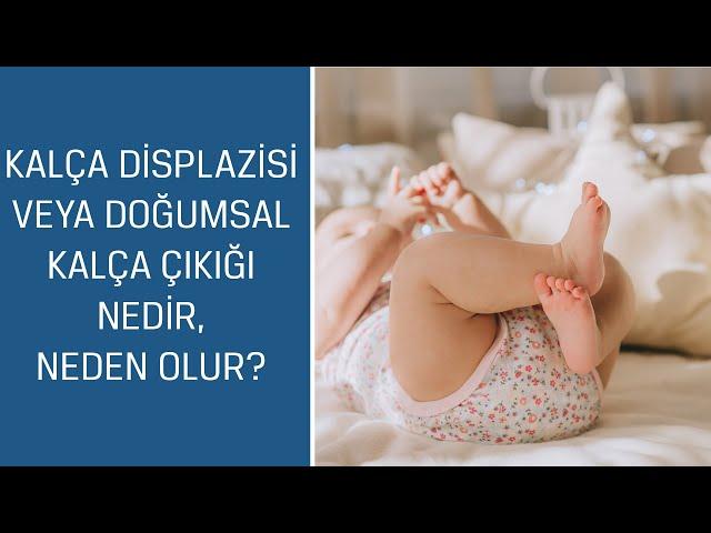 Ortopedi ve Travmatoloji Uzm. Op. Dr. Ozan Ali Erdal: Kalça displazisi nedir, neden olur?