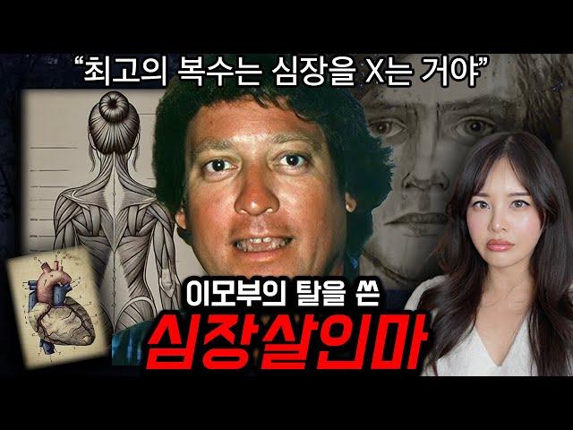 해부학과 처조카, 빅토리아시크릿에 미친 괴물이모부 찰리 #미국실화