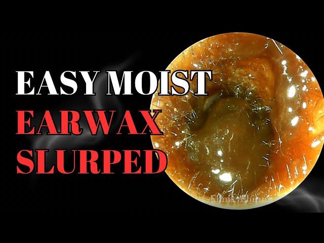 Easy Moist Earwax Slurped