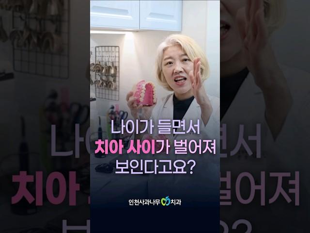 나이가 들면서 이 사이가 벌어져 보인다고요~!