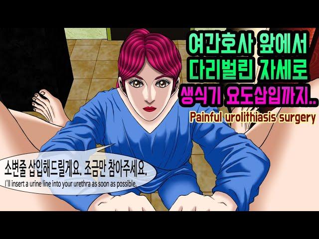 요로결석 수술 후에 소변이 안나와 결국 여자간호사한테 유치도뇨 소변줄 삽입.. 포경수술보다 너무 아픈 요로결석수술썰 Painful urolithiasis surgery.