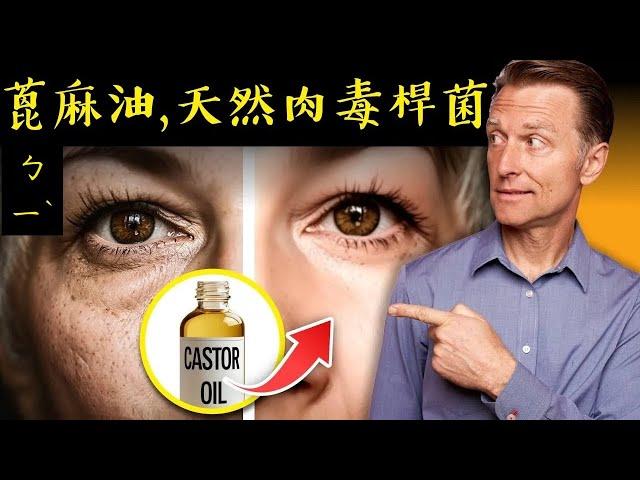 皮膚和頭髮的蓖麻油(Castor Oil)功效,自然療法,柏格醫生 Dr Berg