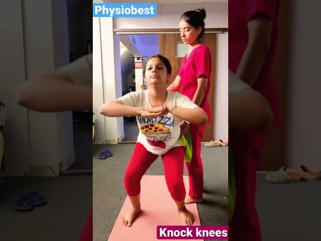 Knock knees exercises #physiotherapy #knock knee #kneepain #kneerehab #chiropracticadjustment