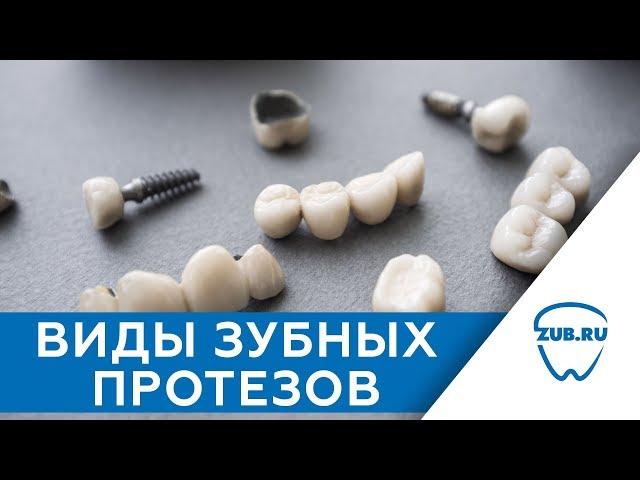 Современное протезирование зубов. Виды зубных протезов