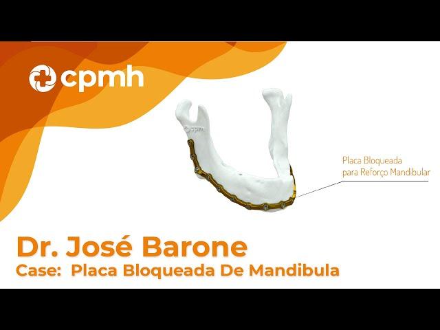 Dr. José Barone - Case com Placa Bloqueada de Mandibula