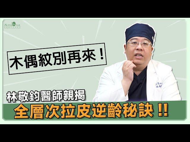 木偶紋別再來！全層次拉皮逆齡秘訣，林敬鈞醫師公開揭曉!｜林敬鈞醫師｜巨星整形外科