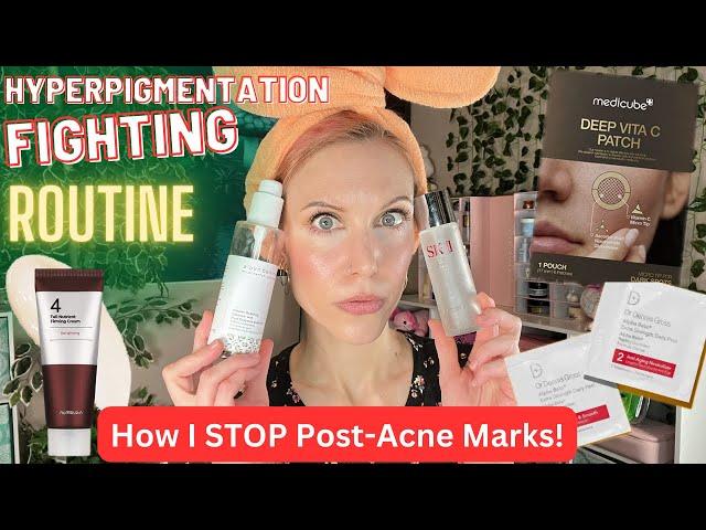 Skincare Routine for GENTLY Fighting Hyperpigmentation!