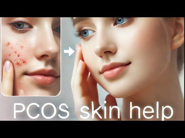 PCOS & Skin: Effective Tips to Manage Acne, Dark Patches, and Hair Issues!