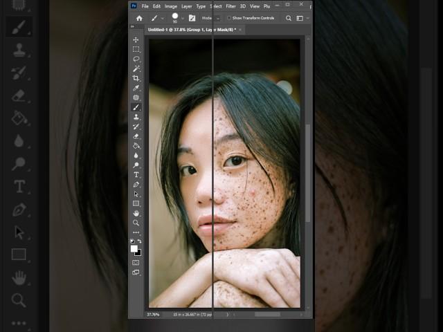 How to Face Acne Removed | Photoshop Skin Retouch 2025 Tutorial #Shorts