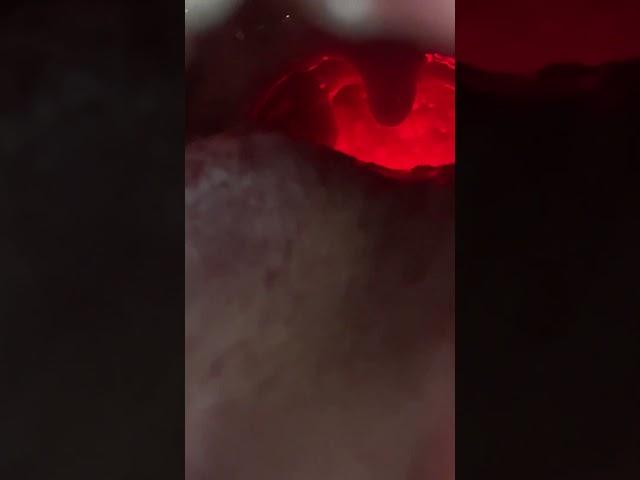 DRAGONS BREATH IRL Shining a Flashlight on Neck Lights up Inside the Throat