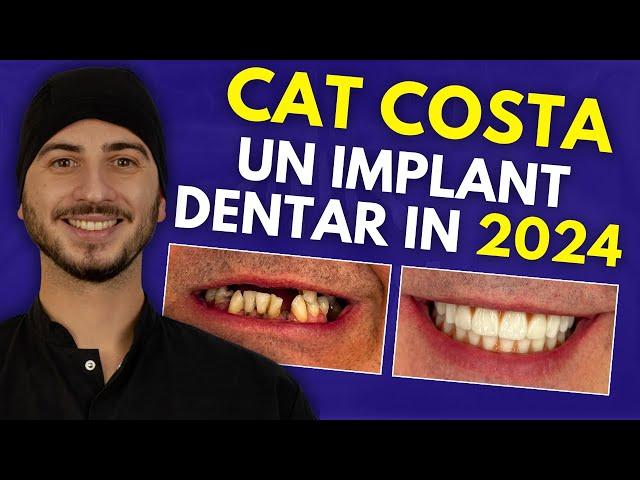 Cat costa un implant dentar? Afla pretul unui implant dentar in 2024