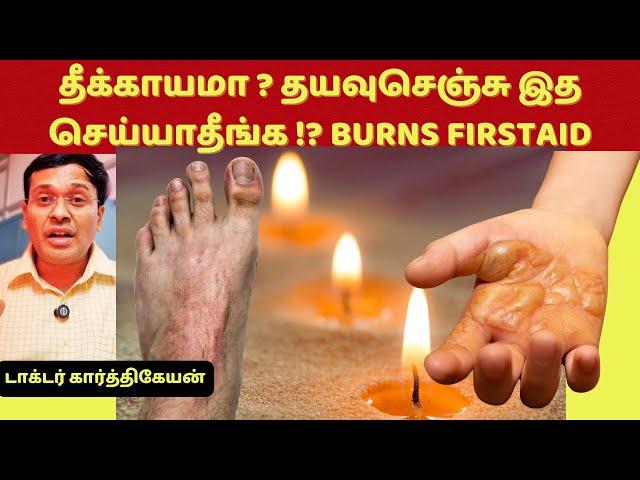 தீக்காயமா? தயவுசெஞ்சு இத செய்யாதீங்க ! 18 first aid treatment tips