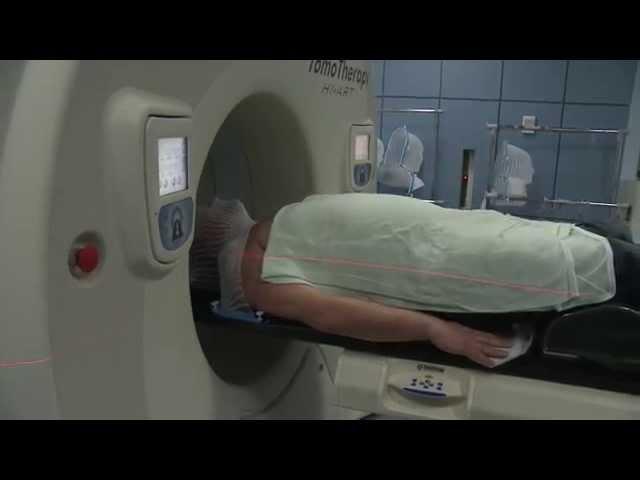 Having Radiotherapy for Brain Cancer