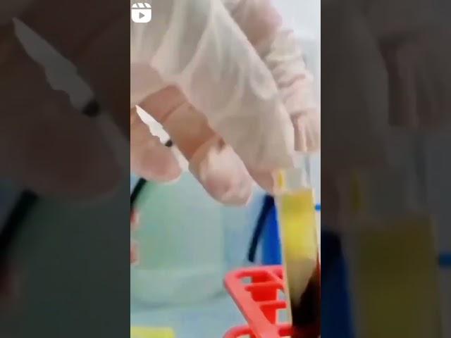 #pathology lab Gyan #️