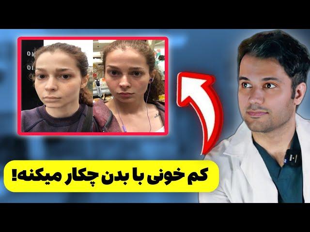 علایم کم خونی فقر آهن |  درمان کم خونی | پیشگیری