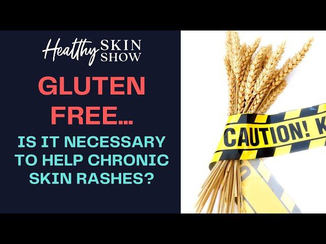 GLUTEN FREE: Necessary To Stop Eczema, Psoriasis, Or Other Rashes? | Jennifer Fugo