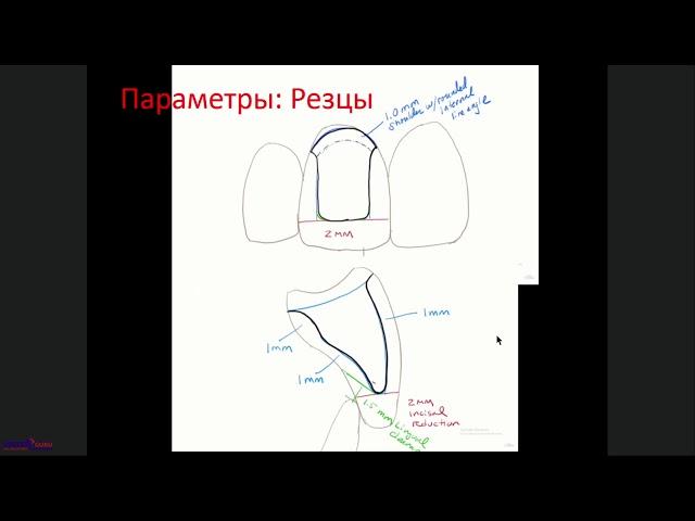 "Методики препарирования зубов под цельнокерамические реставрации."(18.06.2019)