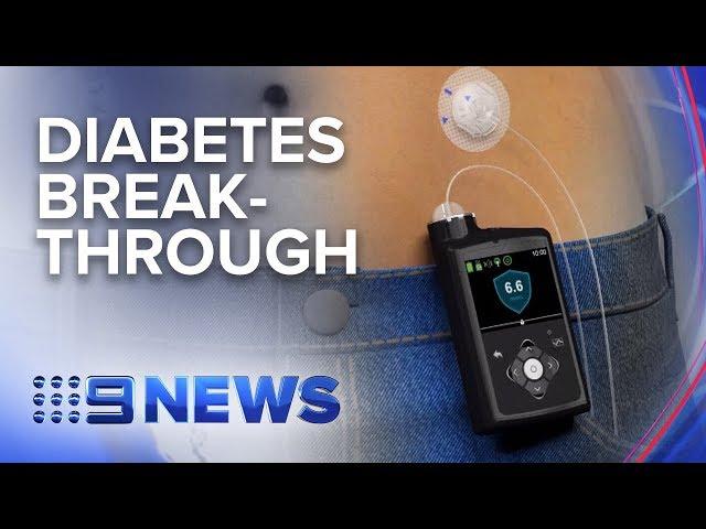 Medical breakthrough for diabetes patients | Nine News Australia