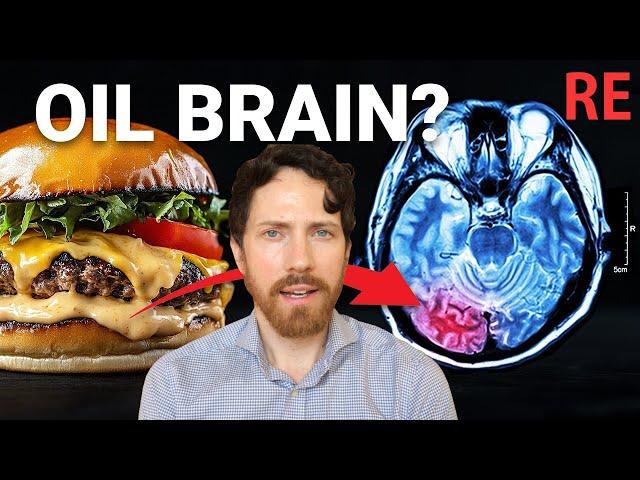 The $212 Billion Dollar Food ingredient poisoning your Brain? RE: What I've Learned