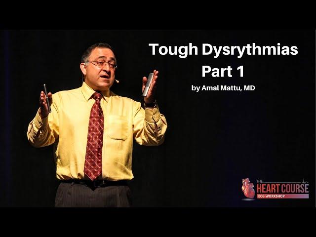 Tough Dysrythmias Part 1 | The Heart Course *Home-Study* ECG Workshop