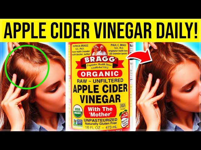 12 POWERFUL Health Benefits Of Apple Cider Vinegar You NEVER KNEW About