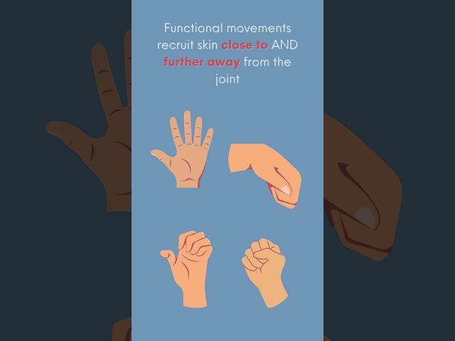 Using Total Active Motion (TAM) to measure composite ROM of the burned hand - Part 1