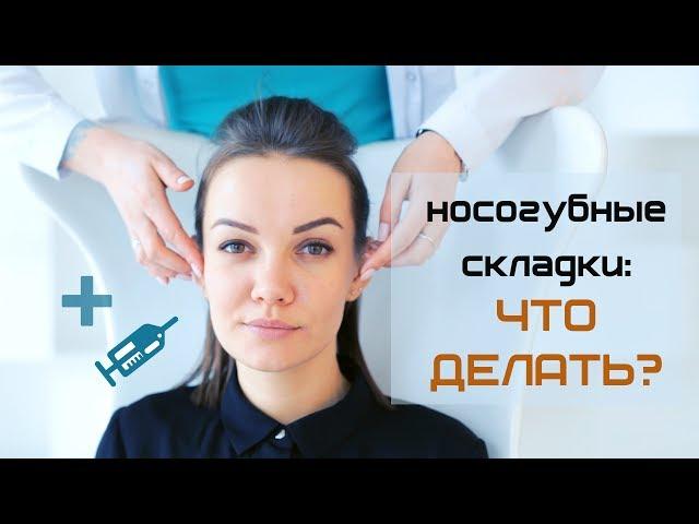 Носогубные складки: как убрать и почему разная стоимость? Коррекция филлерами, до после