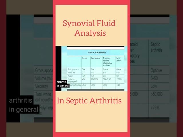 Synovial Fluid Analysis In Septic Arthritis #orthopaedicprinciples #frcsorth