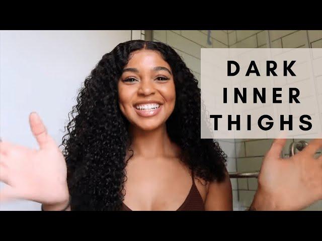 Get Rid Of Body Discoloration, Dark Inner Thighs + More!