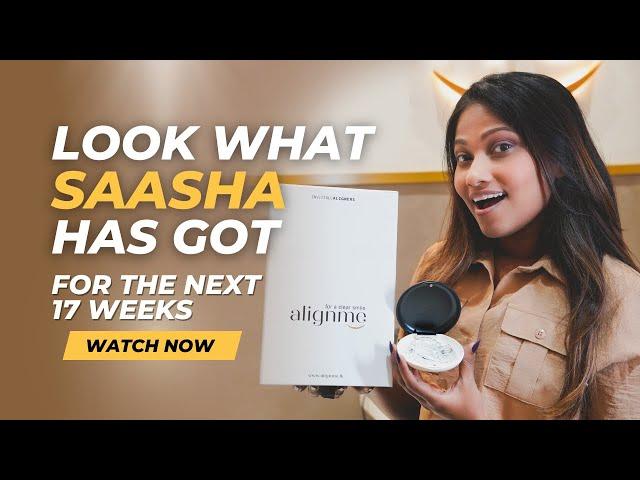 Saasha Karunarathne got her Clear Aligners at Alignme   |   Watch Now   |   Saasha   |   Alignme