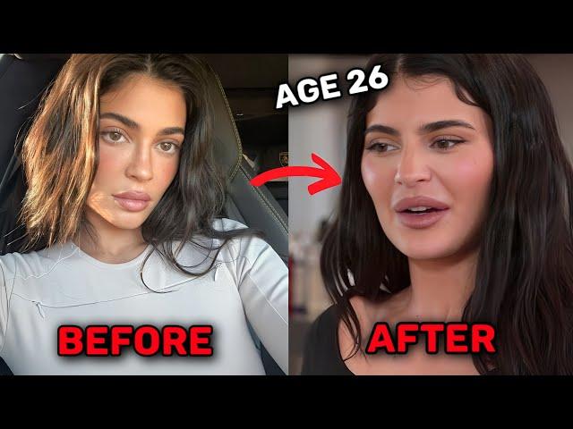 Kylie Jenner Is Now REGRETTING Her Plastic Surgery