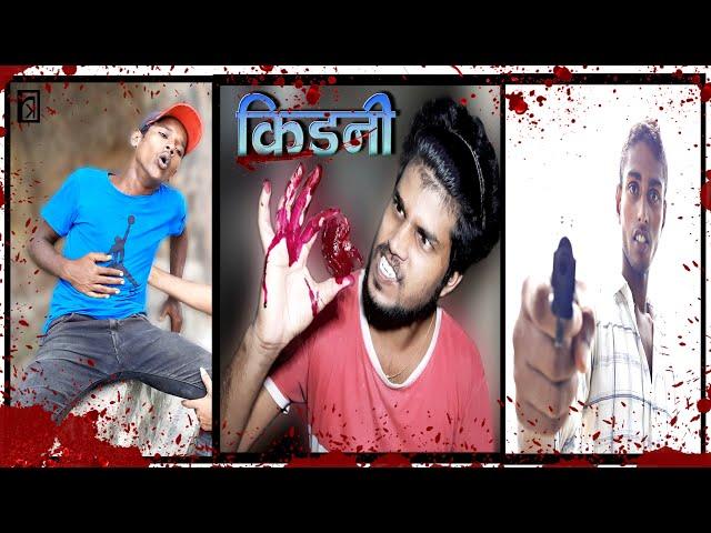 Kidney ( किडनी ) || Maithili Comedy Video || Rakesh Kabirpanthi Official