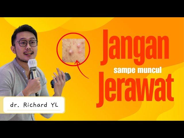 ini kalau ga mau jerawatan Dokter Richard