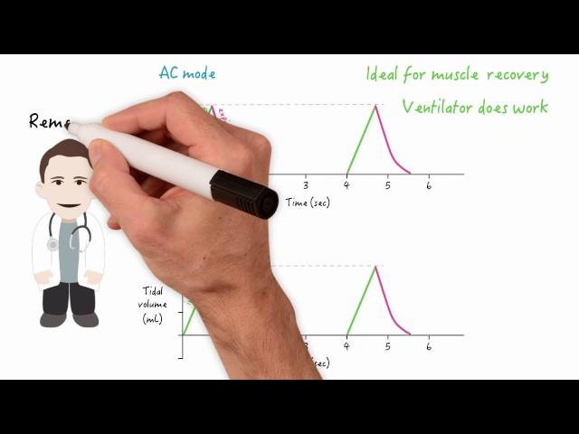 Assist control (AC) and synchronized intermittent mandatory ventilation (SIMV) modes