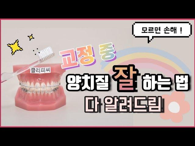 교정 중 '제대로' 양치법 |  + 완전 꿀팁 첨부 [셉템버교정치과]