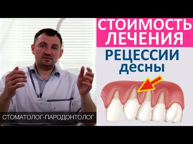 Сколько стоит лечение рецессии десны. Причины опущения десны