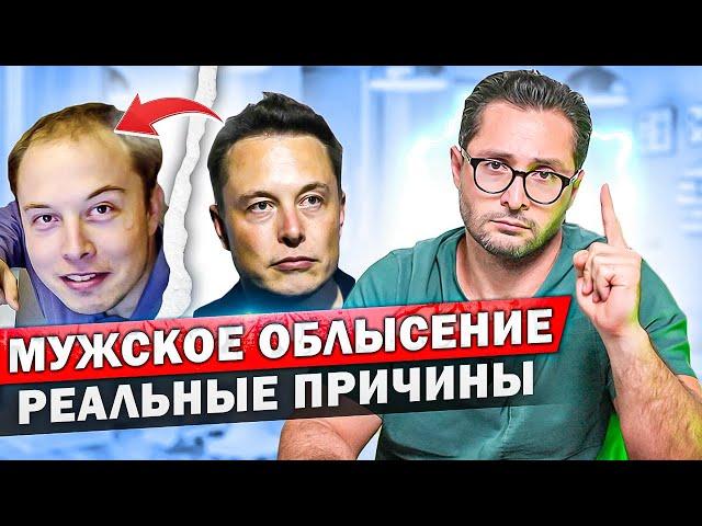 Мужское облысение. Что делать при выпадении волос? Причины и виды лечения.