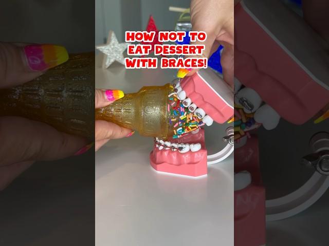 3 DESSERTS to AVOID with BRACES *what to eat instead #braces #dessert #crunchy