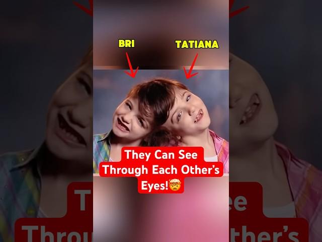 These Twins Share One Mind And Science Can’t Explain It