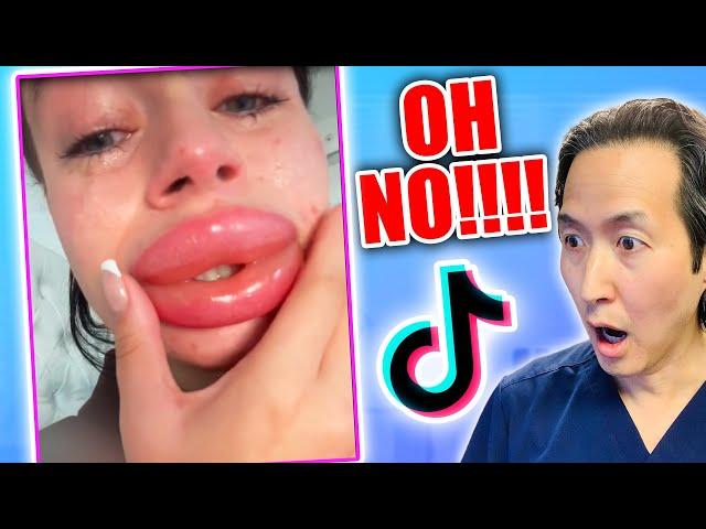 Plastic Surgeon Reacts to UNHINGED DIY Plastic Surgery TikToks!