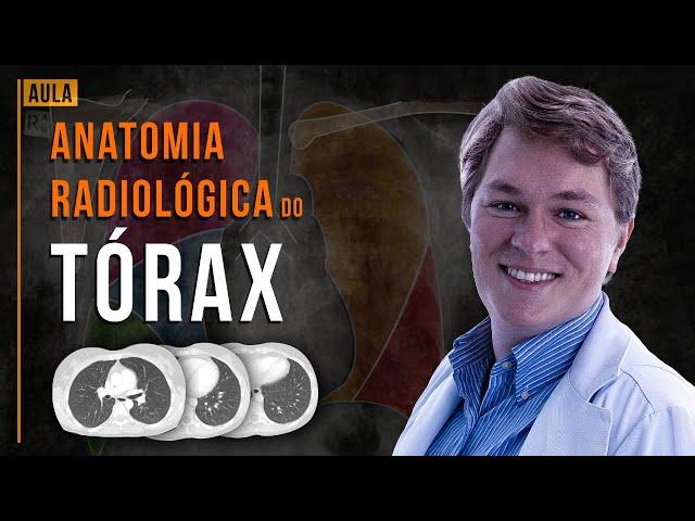 Anatomia Radiológica do tórax