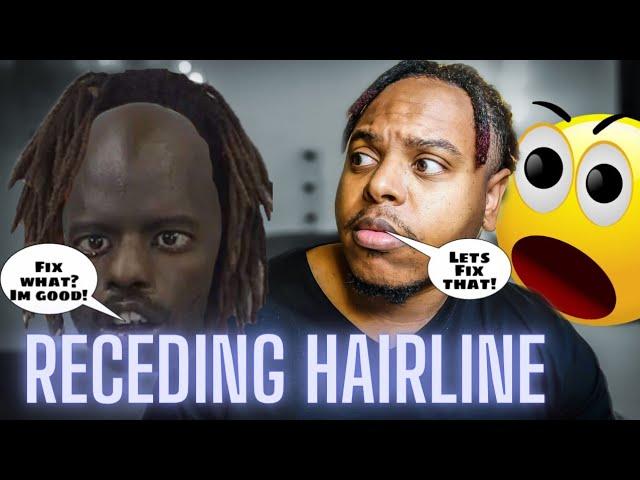 What you can do to prevent a receding hair line | Loc Journey