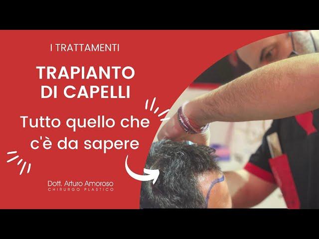 Trapianto di Capelli Tutto Quello Che Devi Sapere - Dott. Arturo Amoroso