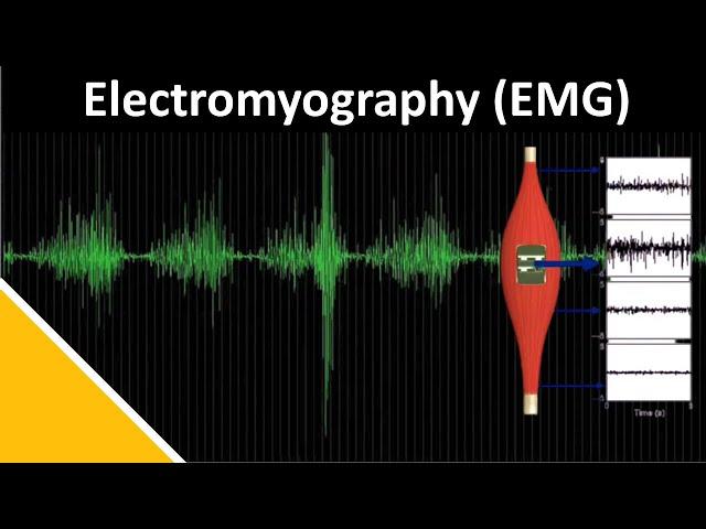 EMG (Electromyography) in Biomechanics | Delsys