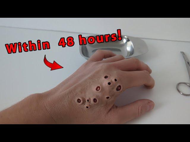 My Trypophobia hand Revealed | What’s Inside? | ASMR Exploration