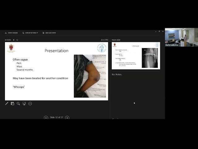 Thomas Hilton- Orthopaedic oncology introduction