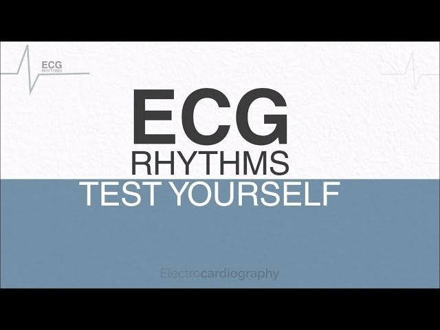 ECG Rhythms for self-assessment: Test ECG Interpretation Skills